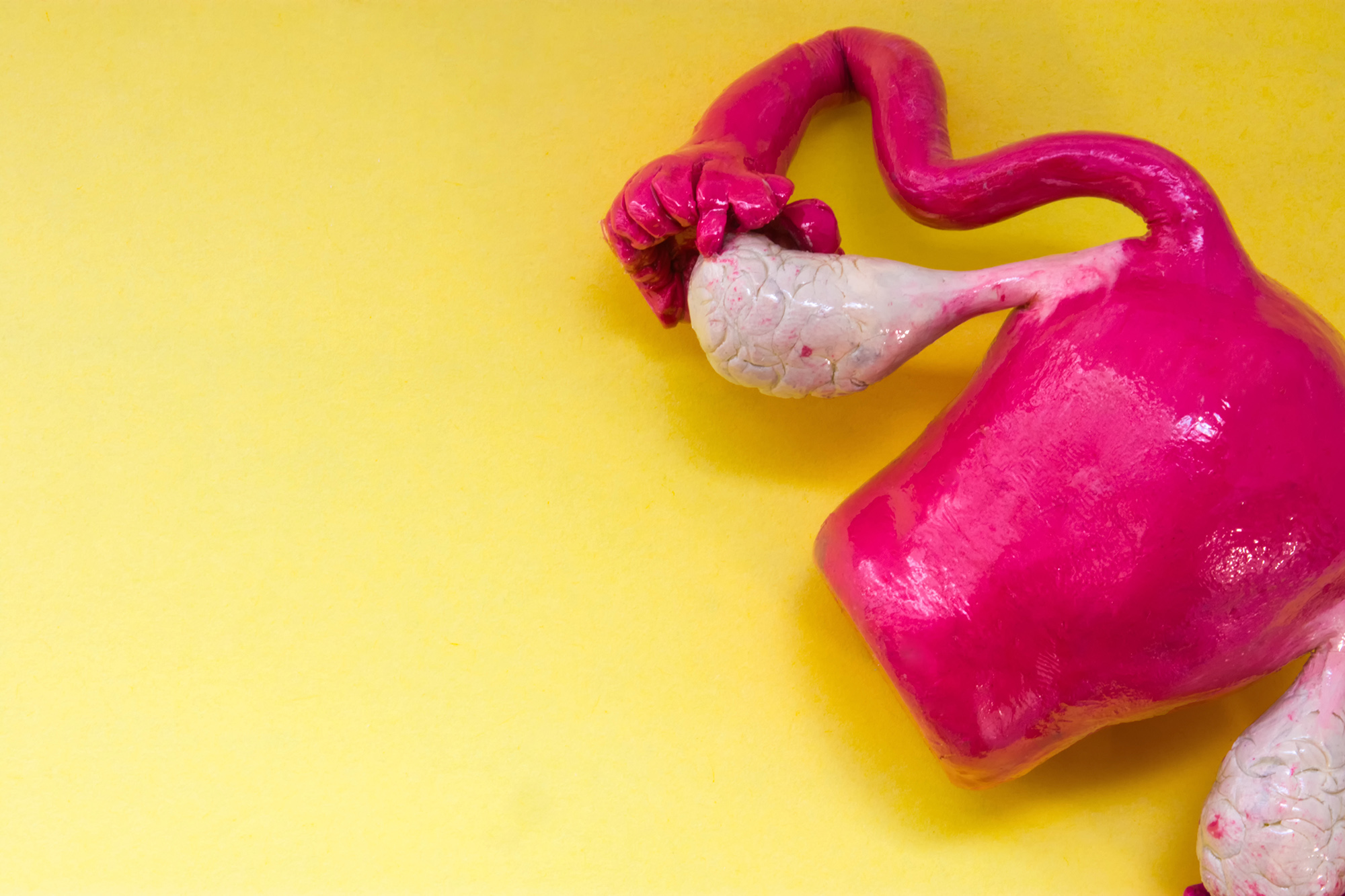 A Endometriose  uma doena progressiva e silenciosa?