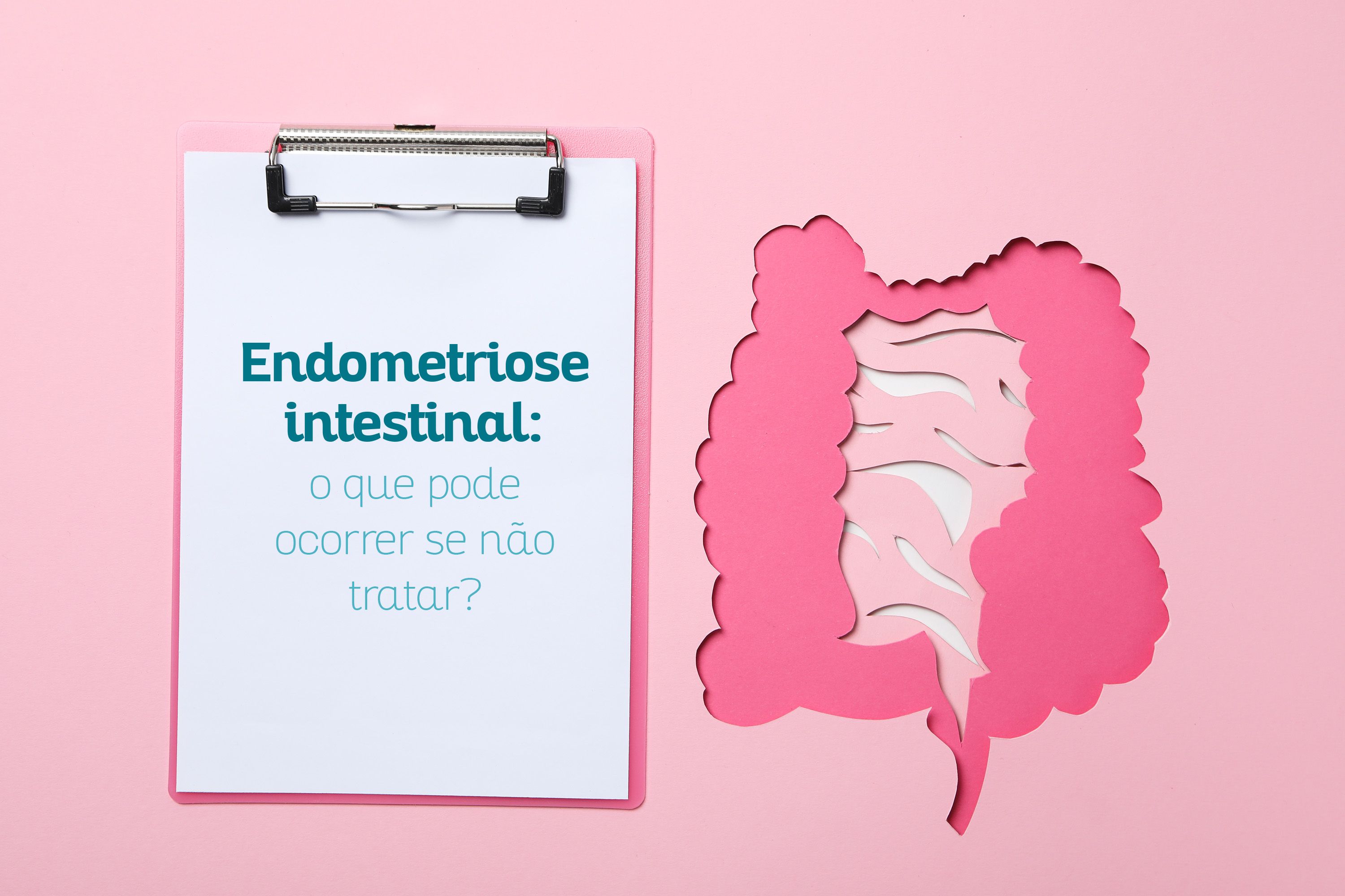Endometriose intestinal: o que pode ocorrer se no tratar?