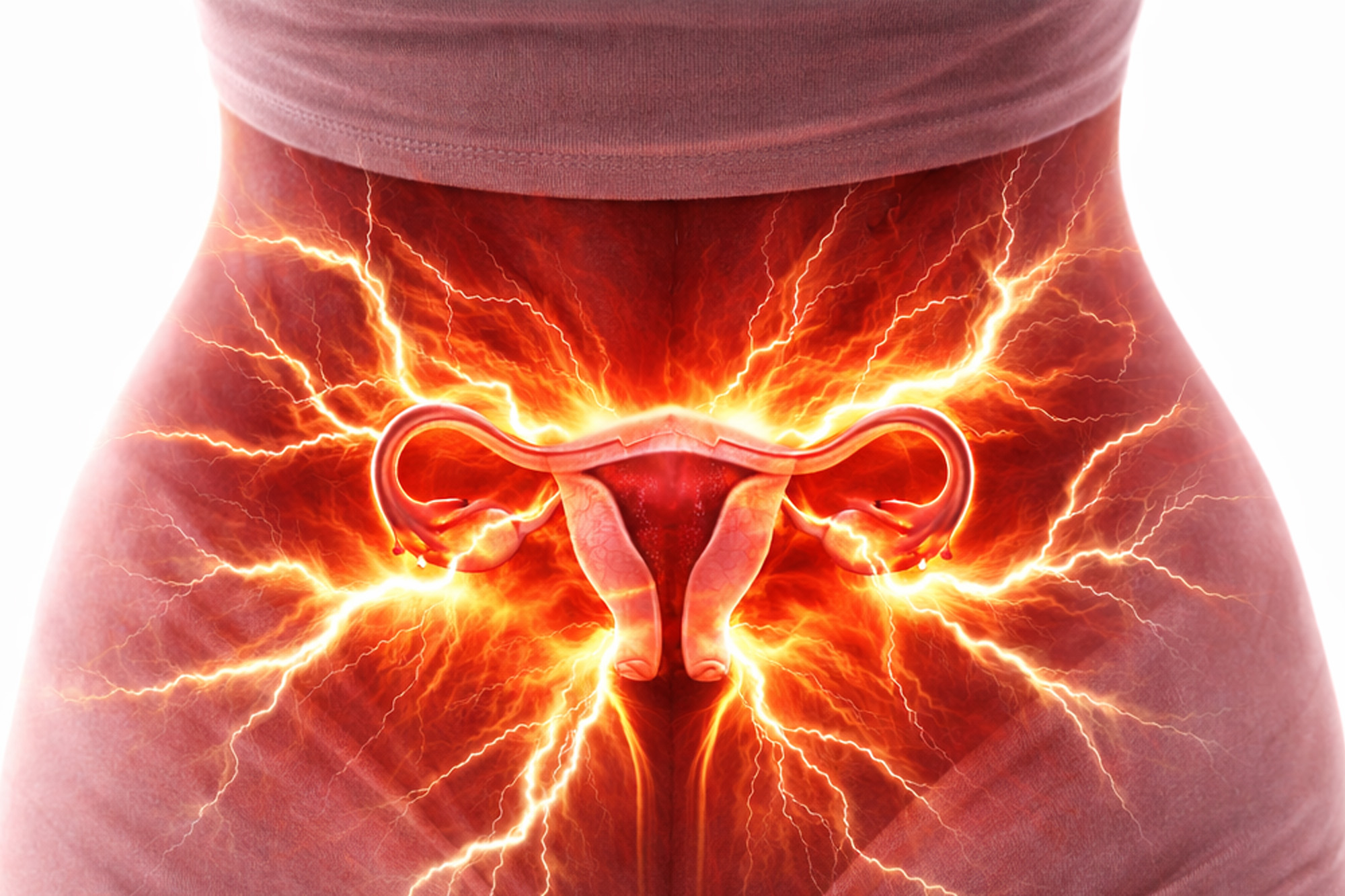 Crises de endometriose podem gerar dor semelhante a contra��es